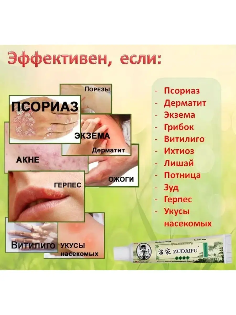 Мазь от псориаза китайская Зудайфу от прыщей экземы акне Здоровье Востока  купить по цене 0 ₽ в интернет-магазине Wildberries | 29561529